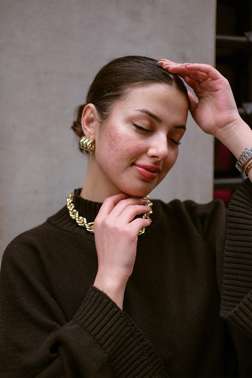 Pele manchas Original Grande